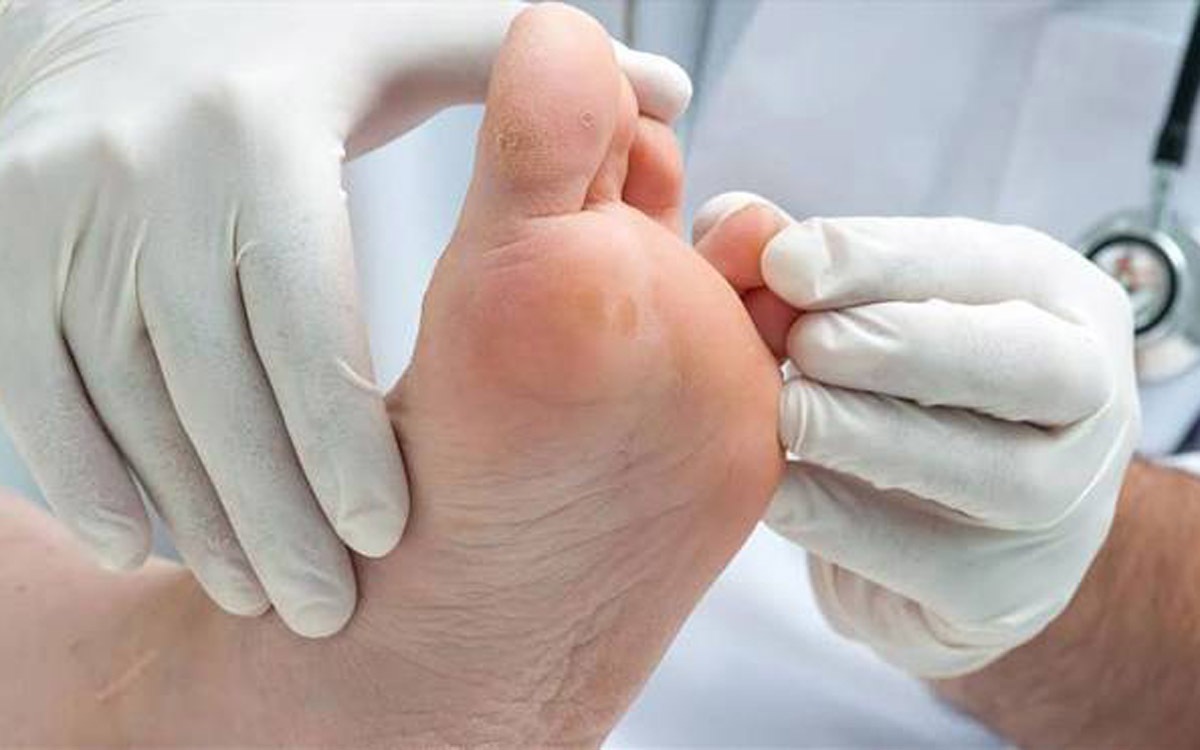 کنترل دقیق قندخون، کلید پیشگیری از مشکلات نوروپاتی دیابتی