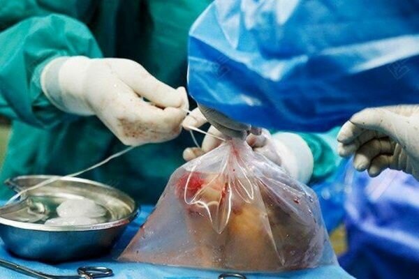 نهمین اهدای عضو سال جاری در یزد رقم خورد