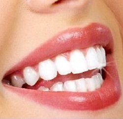 بهترین روش برای سفید کردن دندان کدام است ؟