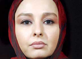 ماهايا پطروسيان:راز گردن درد 20 ساله‌