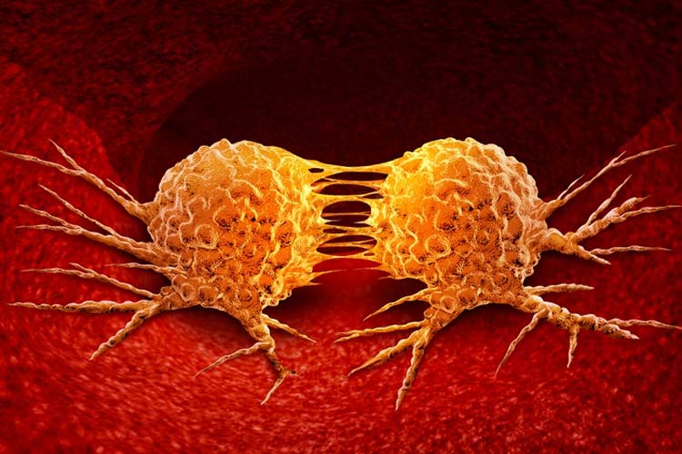 سیستم عصبی چه نقشی در سرطان دارد؟